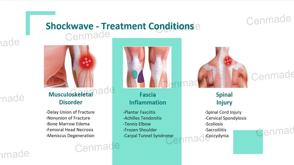 Shock Wave Therapy Device For Physical Therapy Eswt Shockwave Therapy Machine Shock Waves Physiotherapy